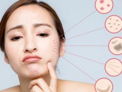 Jika Hal 7 Ini Kamu Alami, Lebih Baik Hentikan Pemakaian Skincare