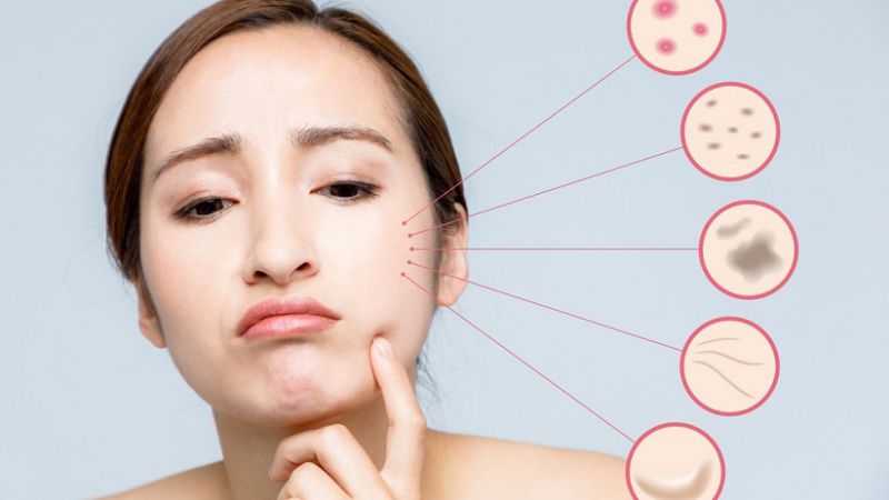 Jika Hal 7 Ini Kamu Alami, Lebih Baik Hentikan Pemakaian Skincare