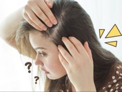 5 Minyak Alami yang Dapat Mengatasi Masalah Rambut