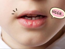 Menyembuhkan Bibir Pecah-pecah dan Kering Dengan 9 Cara Ini